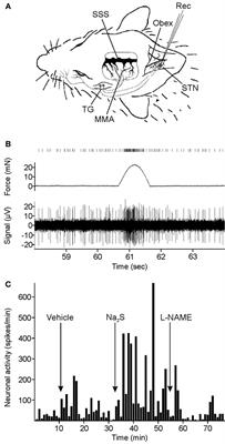 Hydrogen Sulfide Mediating both Excitatory and Inhibitory Effects in a Rat Model of Meningeal Nociception and Headache Generation